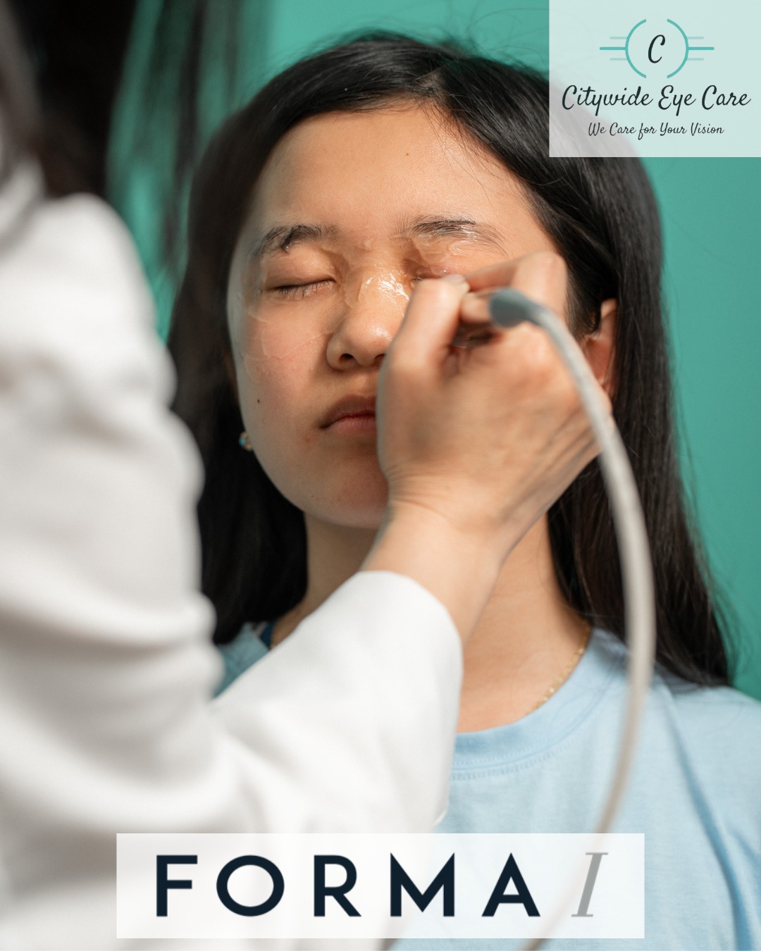 Radiofrequency (RF) Therapy treatment for dry eye syndrome